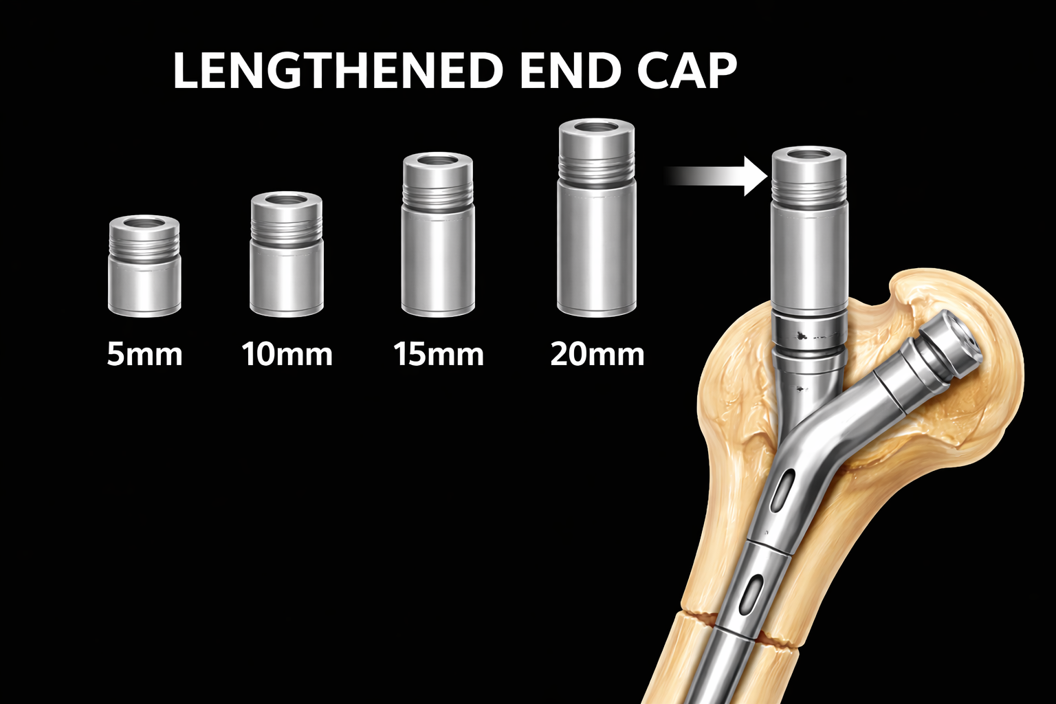 Lengthened End Cap